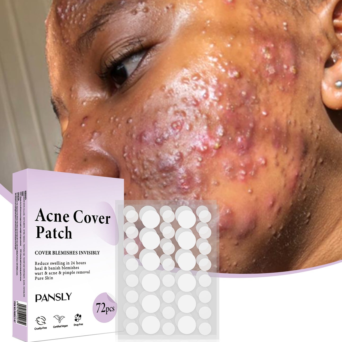 Acne Cover Patch (72PCS/Box)