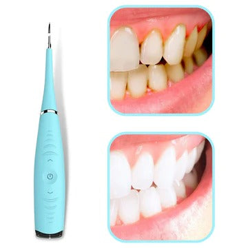 Ultra Sonic Tooth Cleaner - For a perfect smile
