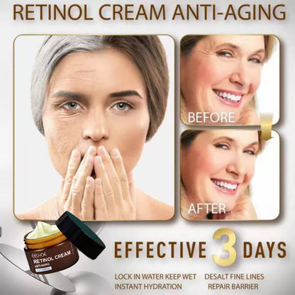 🔥Vibrant Anti-Aging Retinol Cream (2pcs)