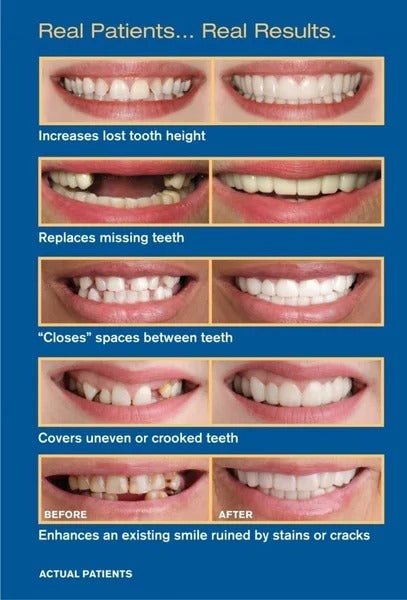 [End-year Clearance Sale] Snap On Smile