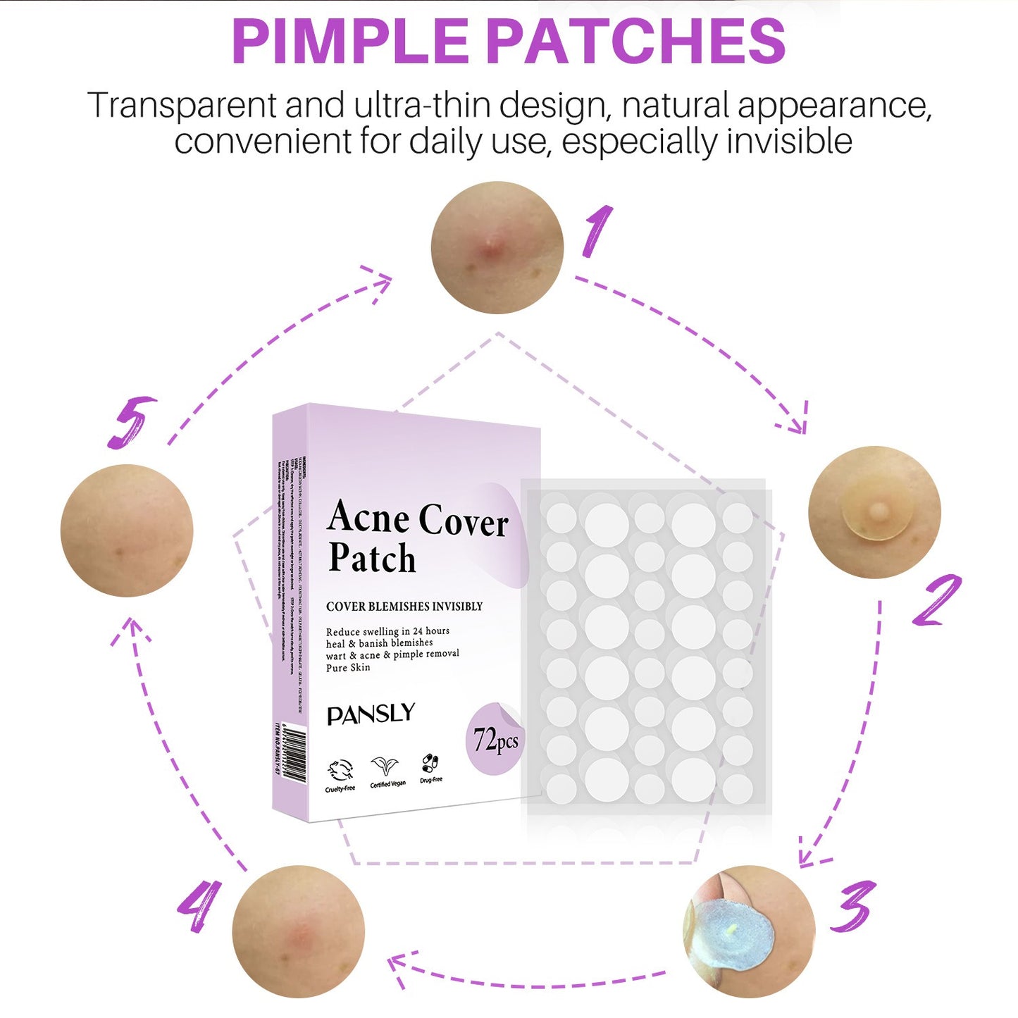 Acne Cover Patch (72PCS/Box)