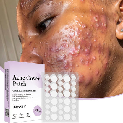 Acne Cover Patch (72PCS/Box)