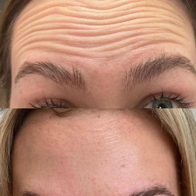 【Mother's Day Sale】Face & Neck Sculptor